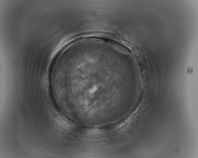 X0000091460198200708161529