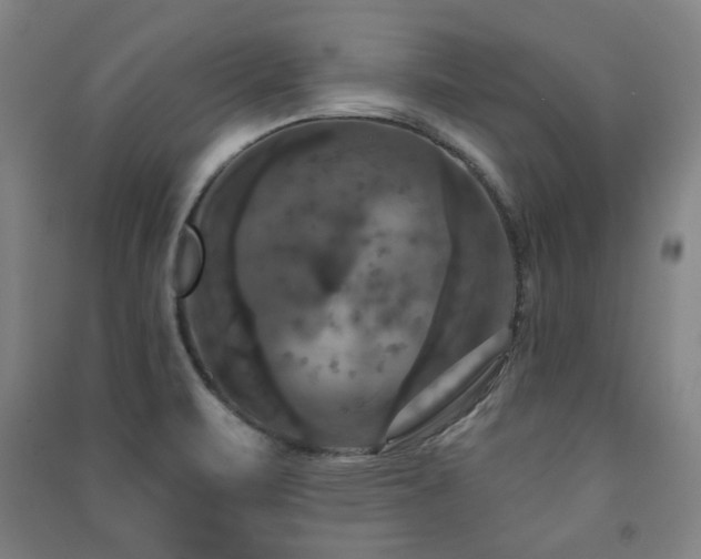 X0000091461471200708161512