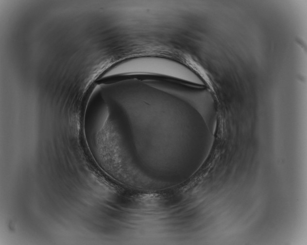 X0000091460059200708231325