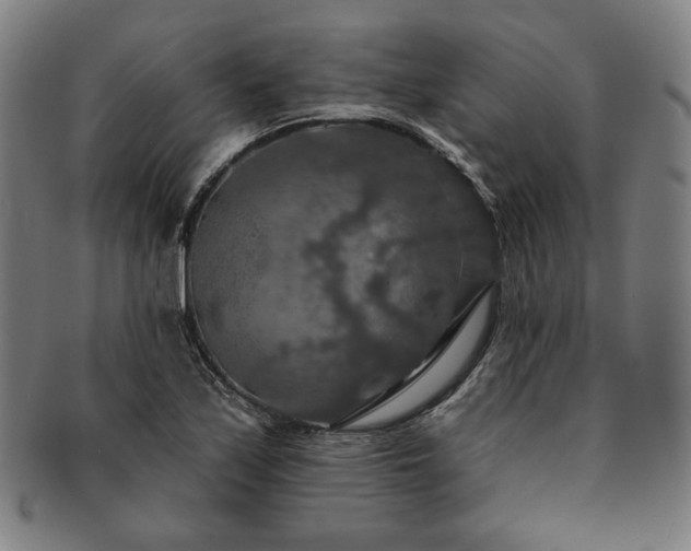 X0000091461171200708231310