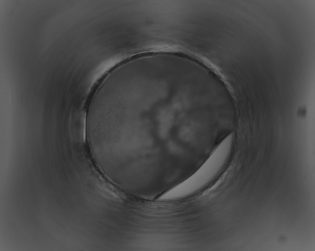 X0000091461171200708301825