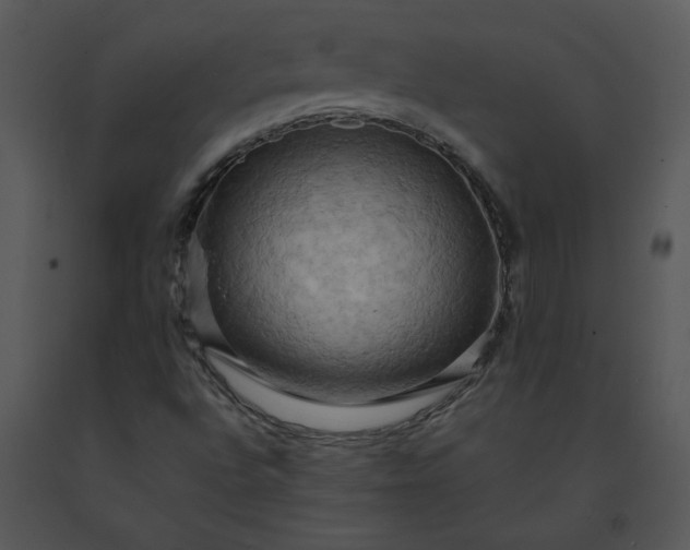 X0000091461496200708301820