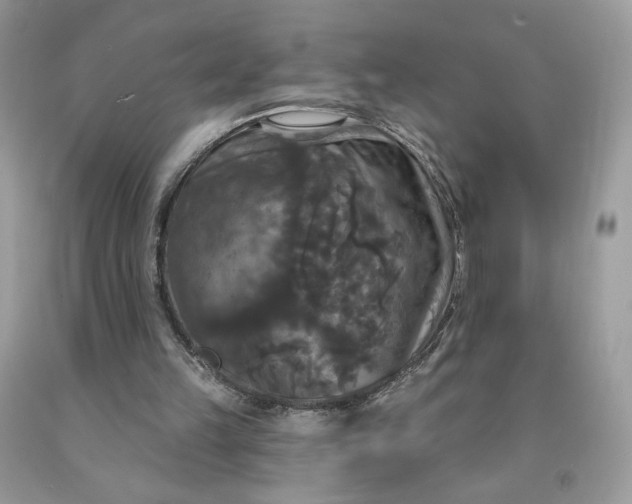 X0000091460149200709061804