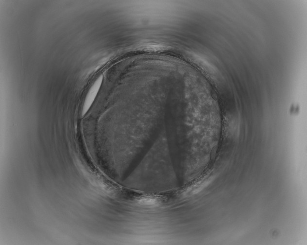 X0000091460358200709061801