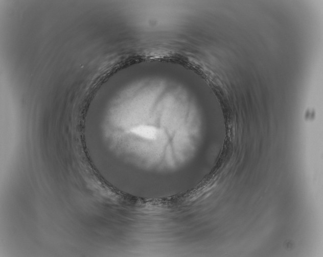 X0000091461393200709061746