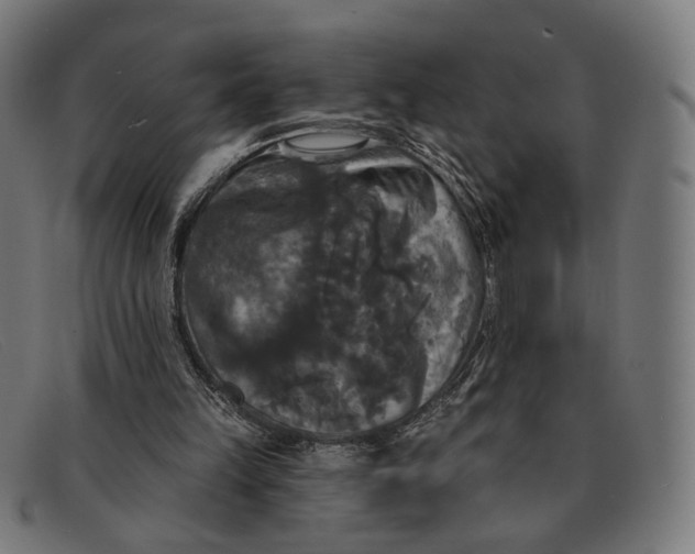 X0000091460149200709131740