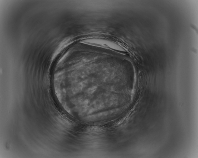 X0000091460198200709131740