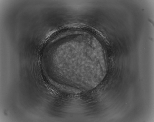 X0000091461158200709131728