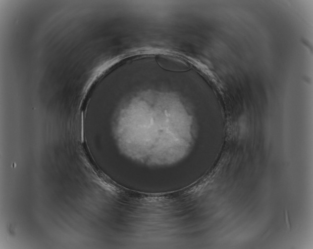 X0000091461223200709131727