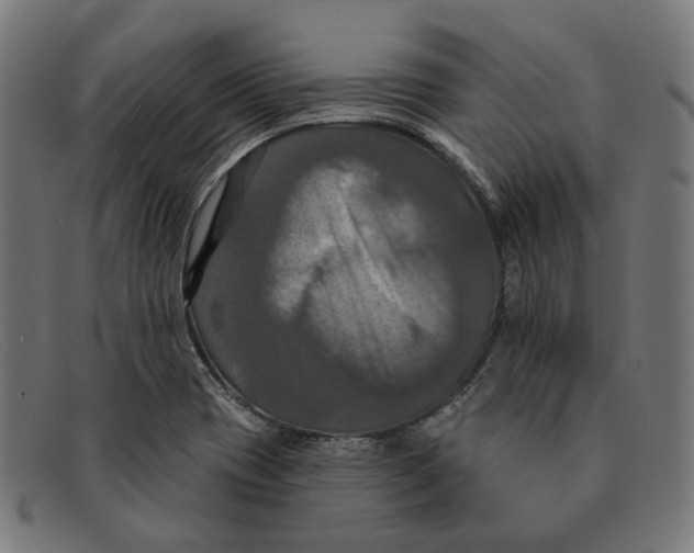 X0000091461417200709131725