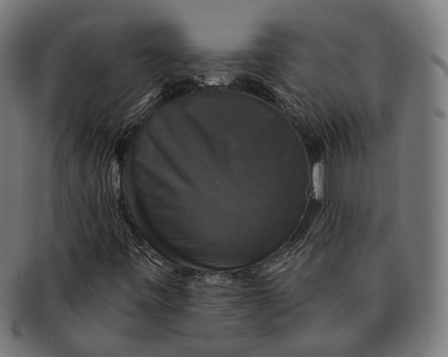 X0000091461443200709131725
