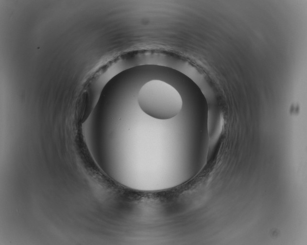 X0000091470256200708161405