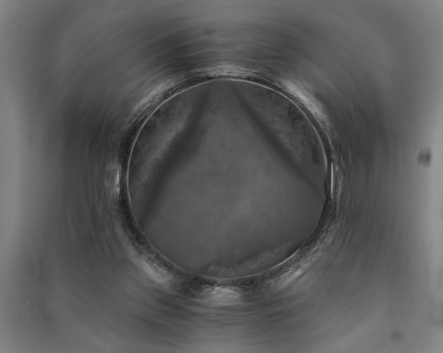 X0000091480157200708161426