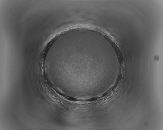 X0000091481496200708161408