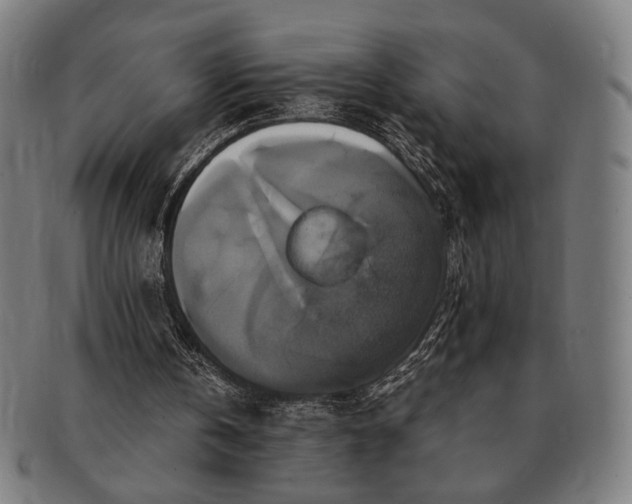 X0000091480146200708231407