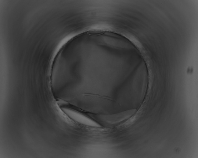 X0000091481248200708301907