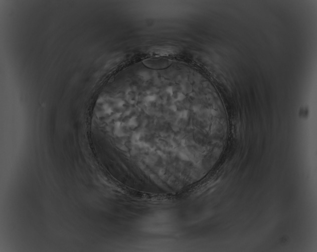 X0000091481393200708301904