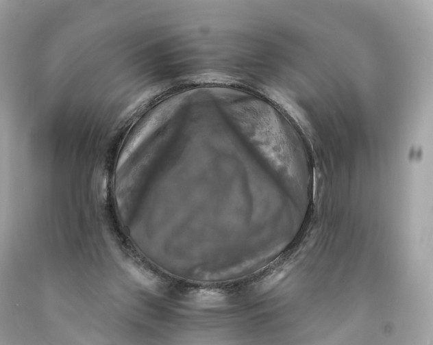 X0000091480157200709061847