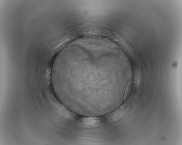 X0000091480378200709061844