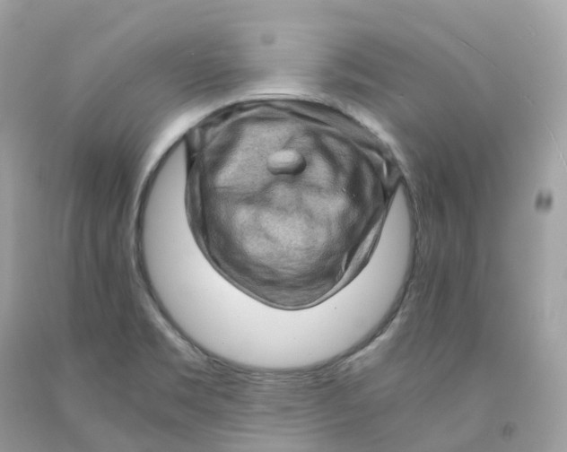 X0000091481469200709061829