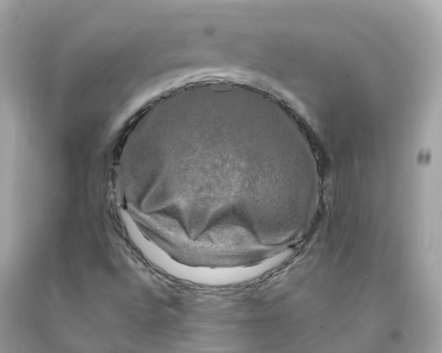 X0000091481496200709061828