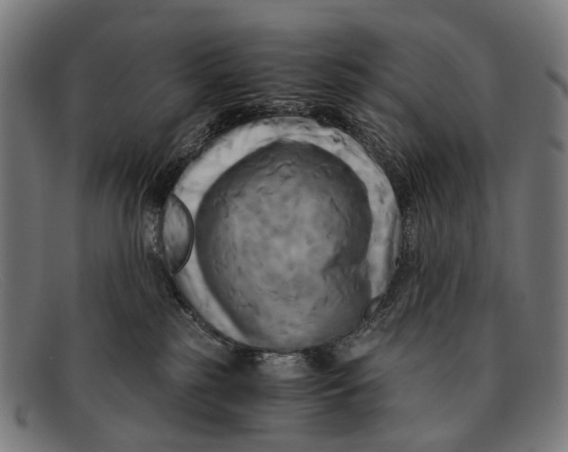 X0000091480185200709131819