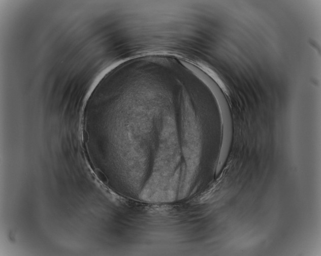 X0000091481148200709131807