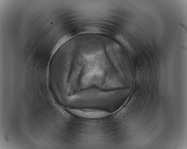 X0000091481378200709131803