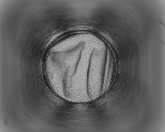 X0000091481404200709131803