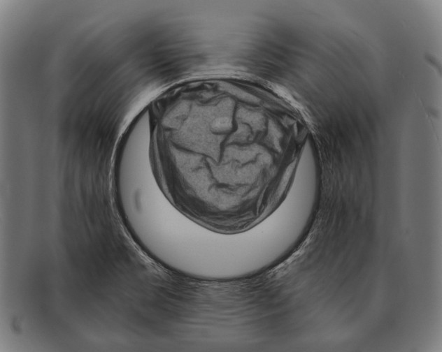 X0000091481469200709131802