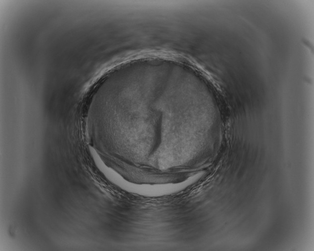 X0000091481496200709131801