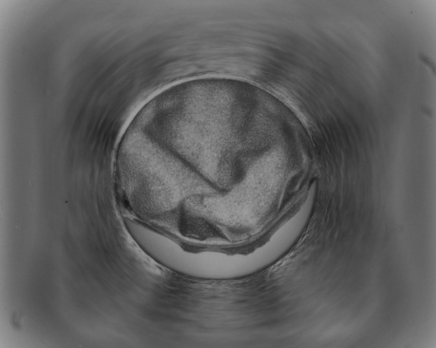 X0000091481532200709131802