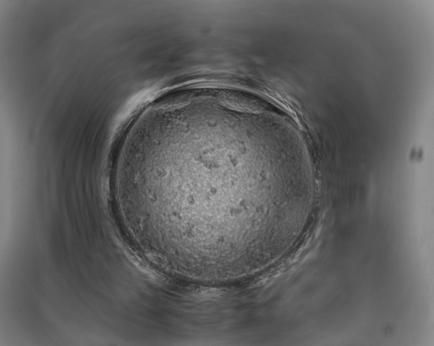 X0000091490149200708161445