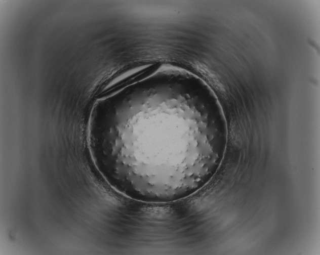 X0000091490449200708231425