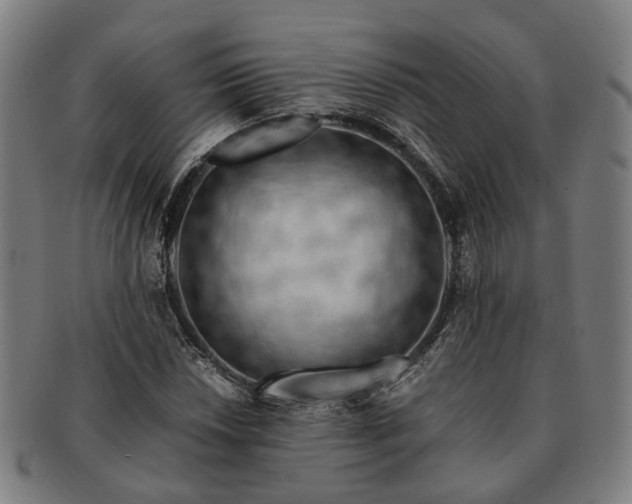 X0000091491018200708231417