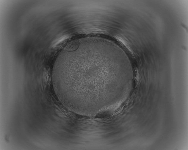 X0000091491063200708231417