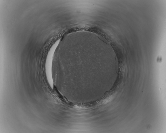 X0000091490818200709061859