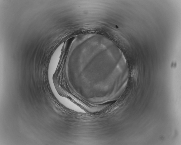 X0000091490868200709061859