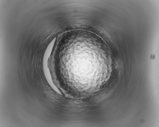 X0000091490915200709061857