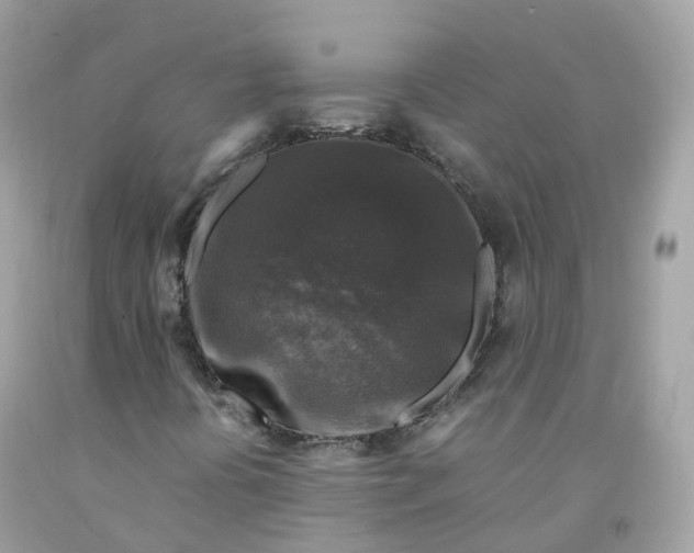 X0000091491394200709061851