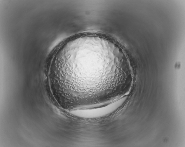 X0000091491400200709061851