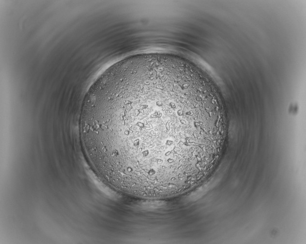 X0000091491417200709061851