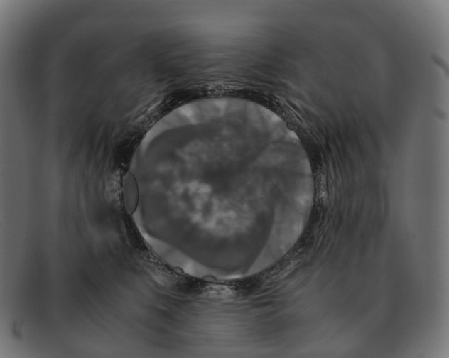 X0000091490519200709131833