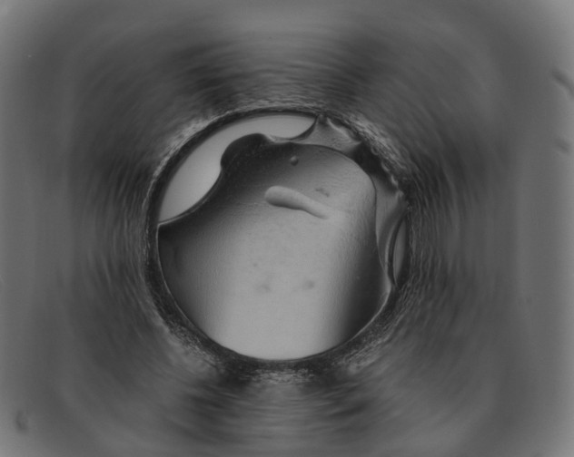 X0000091490540200709131832