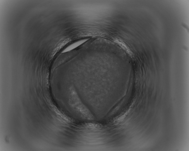 X0000091490585200709131832