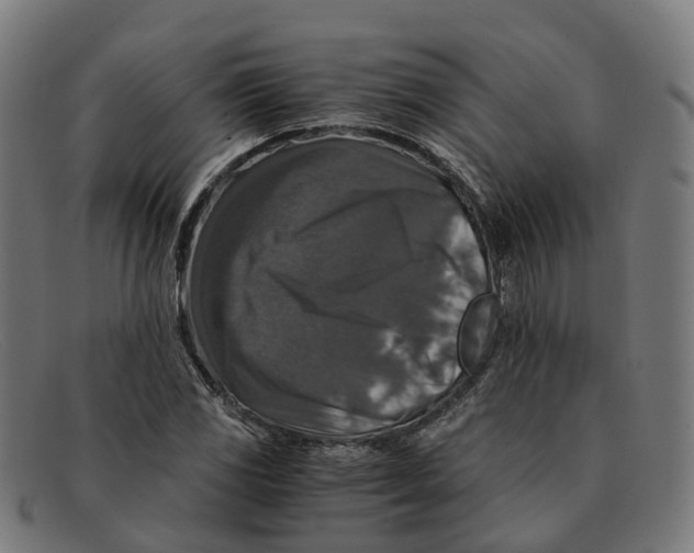 X0000091491117200709131825