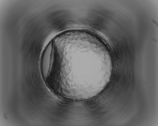 X0000091491472200709131821