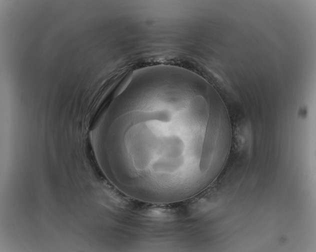X0000091500657200708161500