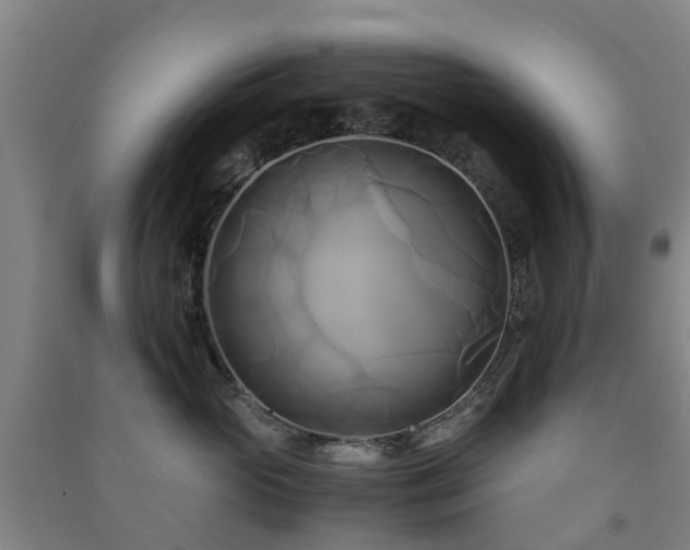 X0000091500765200708161458