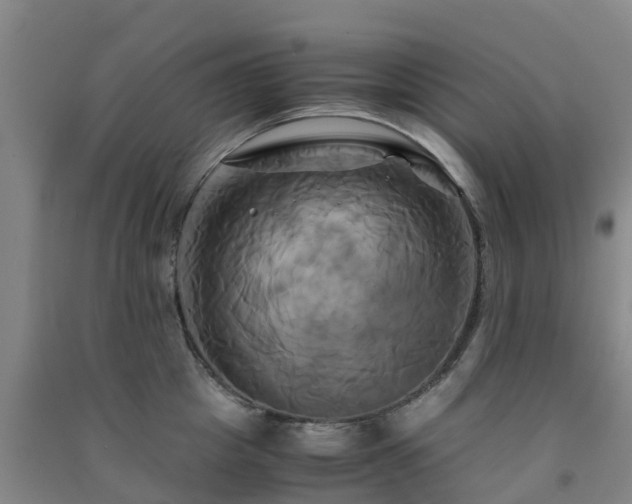 X0000091500857200708161457